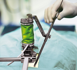 Specialized equipment used during robotic-assisted spine surgery at Morton Plant Hospital