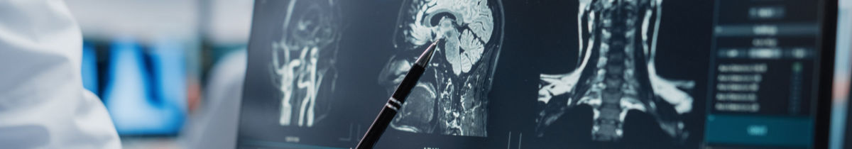 Medical professional analyzing a brain scan.