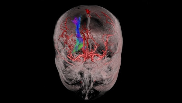 Brain Image for VR
