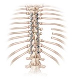 Illustration of a spine.