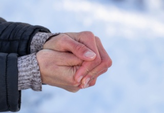 Woman's hands with dry skin and red fingers in the cold winter environment.