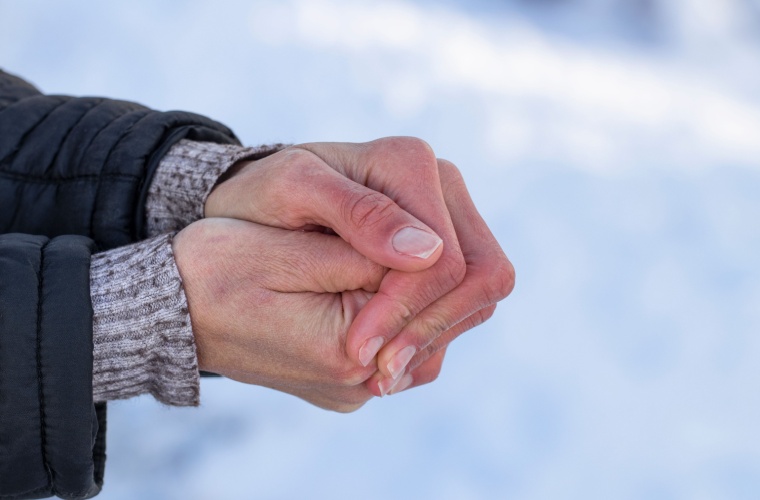 Woman's hands with dry skin and red fingers in the cold winter environment.