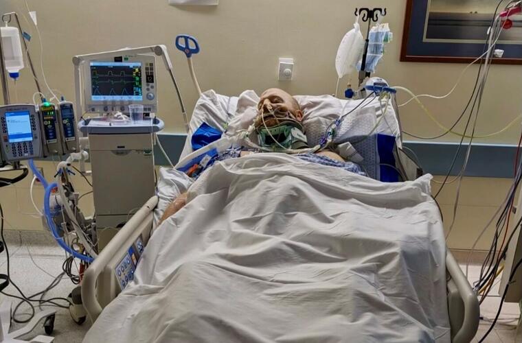 A man lays in a hospital bed with medical equipment attached to him in critical condition.