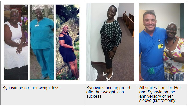 Synovia before and after weight loss with her bariatric surgeon, Dr. Hall
