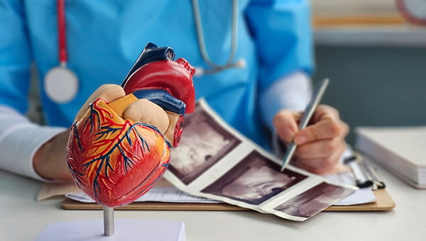 Doctor examining a heart x-ray next to a model of a heart