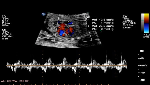 Screenshot of the results of an echocardiography machine