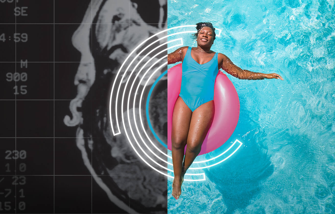 An image split in half with with a medical scan on the right side and a female floating in a pink tube in a pool, joined together with The BayCare effect logo