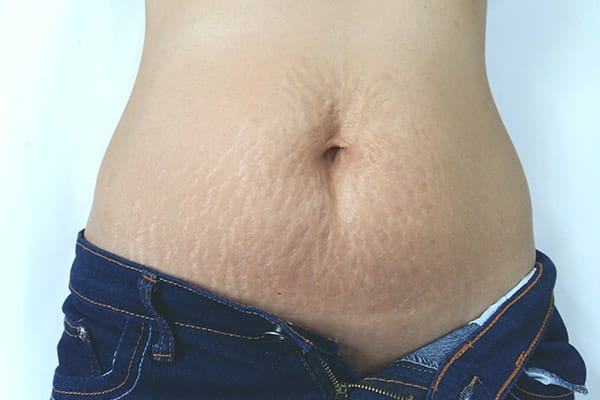 postpartum pelvic pain postpartum pelvic pain