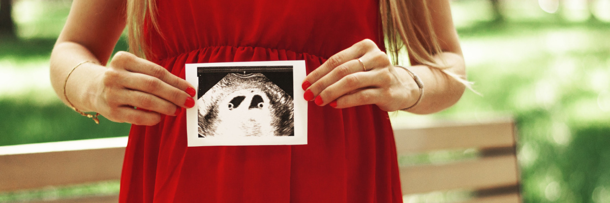Pregnant woman holds in her hands an ultrasound scan of twins in the first trimester.
